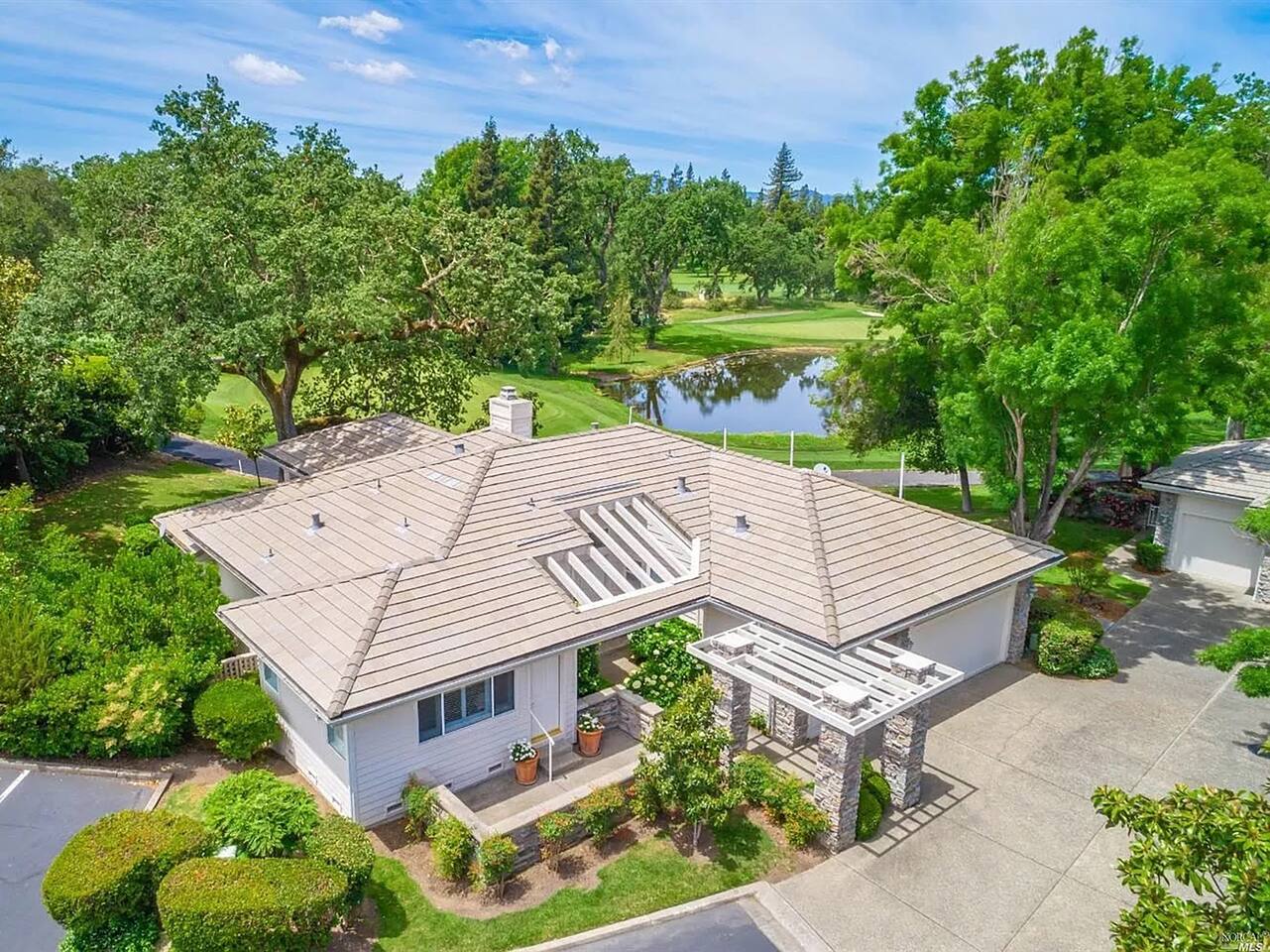 Experience exclusivity and tranquility in Silverado Napa Retreat, where luxury living meets serene surroundings.